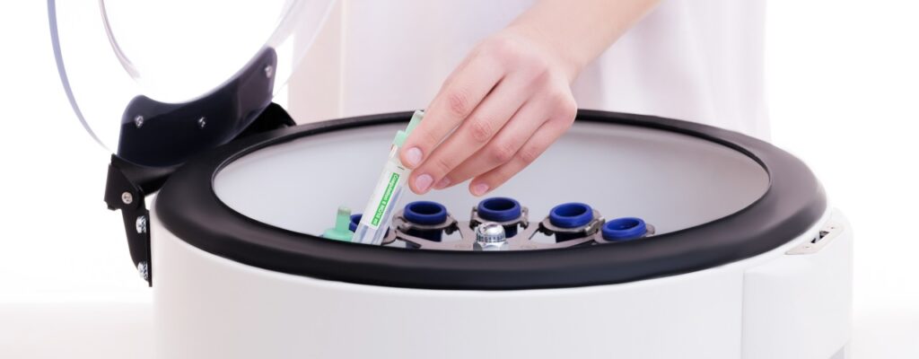 Navigating the Road to Recovery: Combining PRP, Stem Cell Therapy, and Sports Medicine