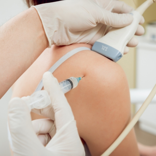 Ultrasound-Guided-Injections-Sievers-Sports-Medicine-Clovis-Portales-NM