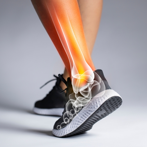 ankle-pain-relief-Sievers-Sports-Medicine-Clovis-Portales-NM