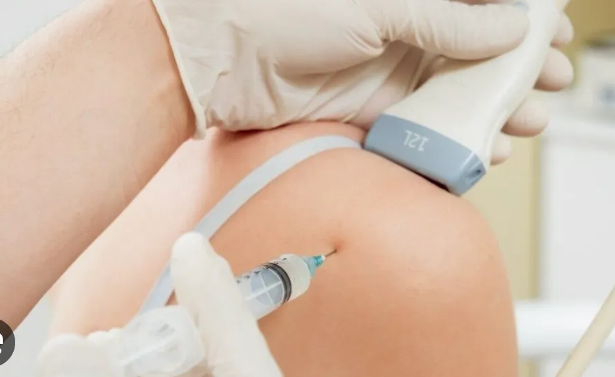 Treatment Spotlight: Percutaneous Needle Tenotomy
