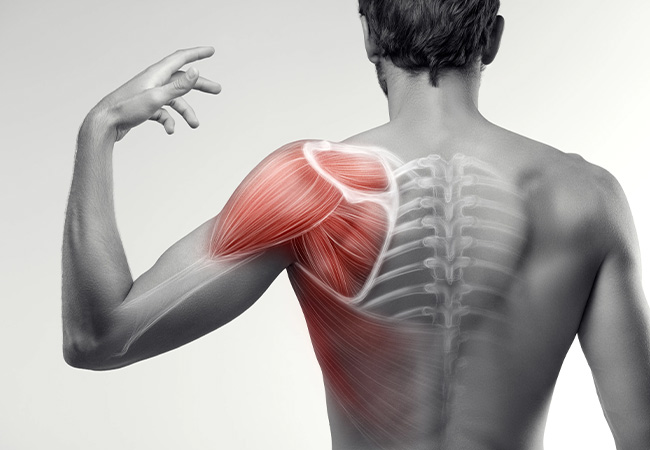 Healing Rotator Cuff Injuries: From Urgent Relief to Regenerative Recovery